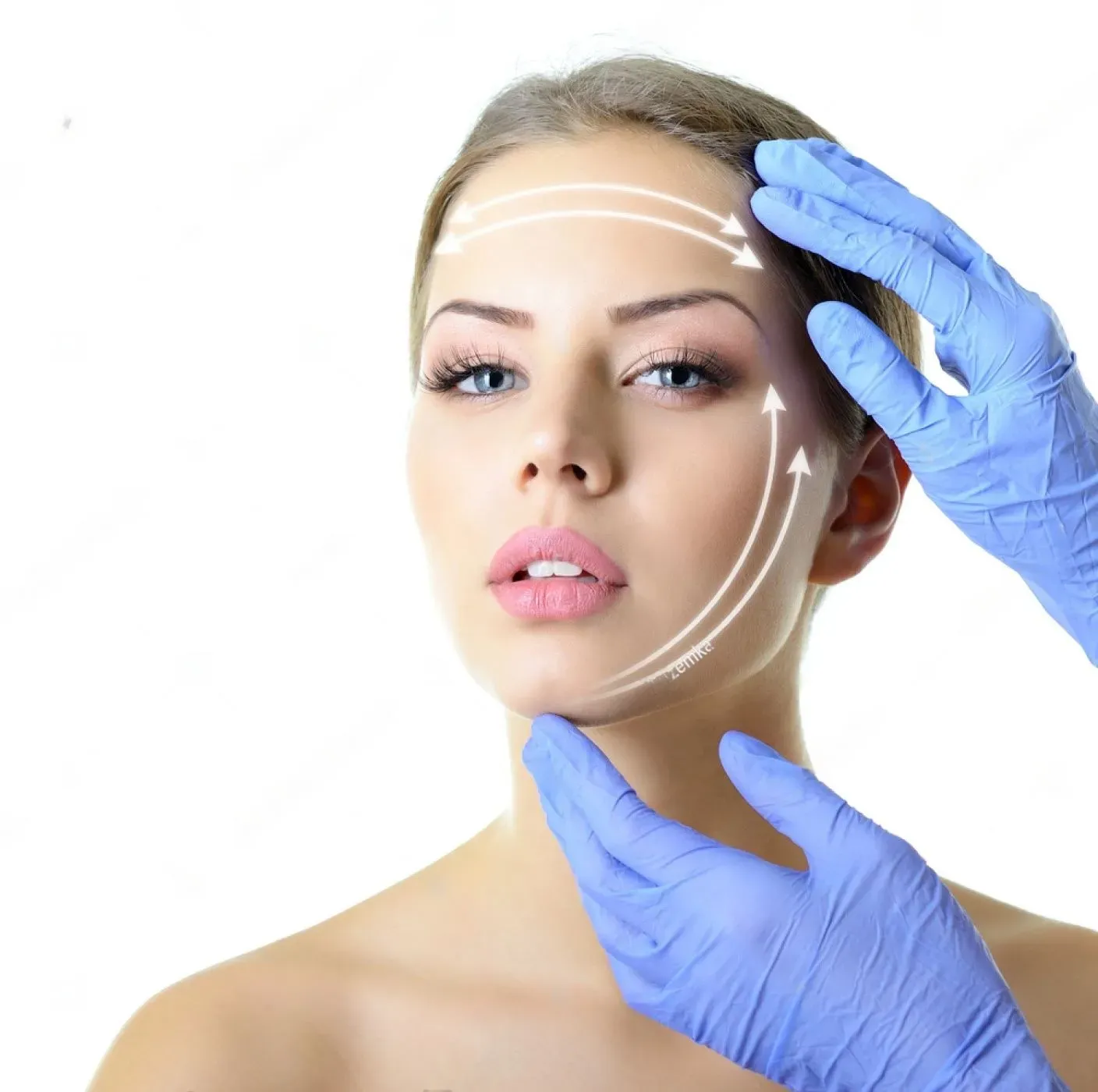 Nonsurgical NovaThreads Facelift - PDO Thread Lift