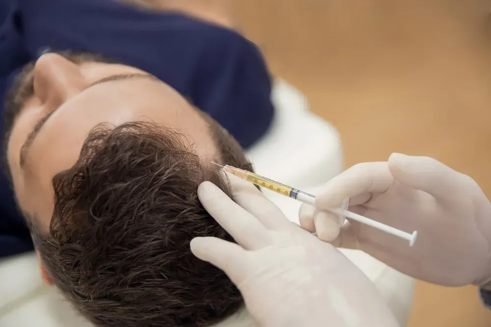 When to Consider PRP Therapy for Hair Loss