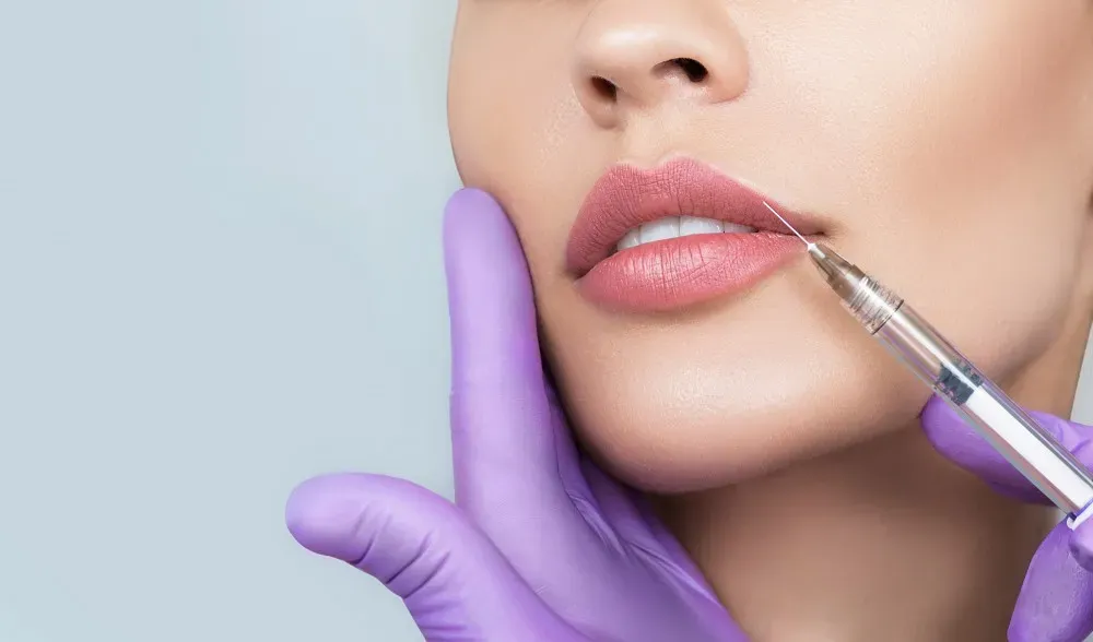 Plumper Lips with Dermal Fillers: All Your Questions Answered